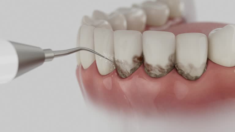Reliable Tooth Extraction contractor in Canadian County County, OK by Dentist Open Now